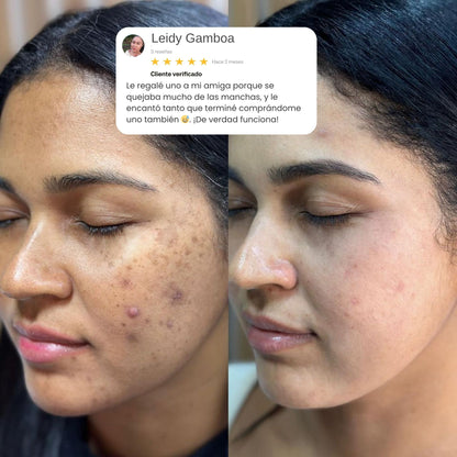 PDRN DE SALMÓN™- El secreto coreano para una piel radiante